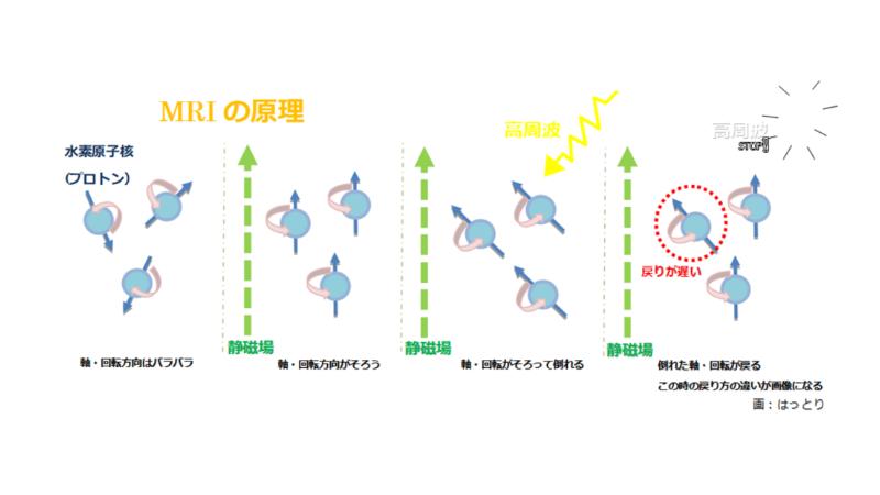 MRIの原理を表す図