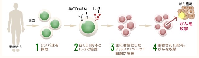 アルファ・ベータT細胞療法（αβT細胞療法）について説明した図