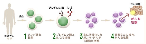 ガンマ・デルタT細胞療法（γδT細胞療法）について説明した図