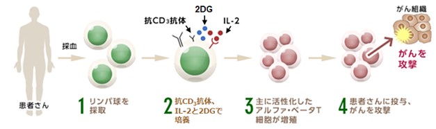 2DG･キラーT細胞療法について説明した図